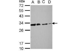WB Image Sample (30 ug of whole cell lysate) A: 293T B: A431 C: HeLa D: HepG2 12% SDS PAGE antibody diluted at 1:10000 (DCK Antikörper)