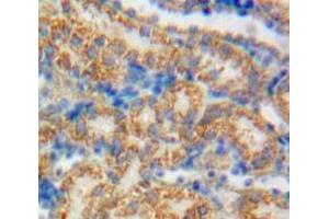 Used in DAB staining on fromalin fixed paraffin-embedded Kidney tissue (GAS6 Antikörper  (AA 59-221))
