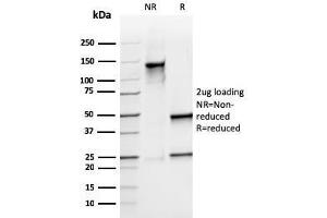 SDS-PAGE Analysis Purified S100A9 Recombinant Mouse Monoclonal Antibody (rMAC3781). (Rekombinanter S100A8 Antikörper)