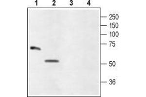 Western blot analysis of rat eye (lanes 1 and 3) and ARPE-19 (lanes 2 and 4) lysates: - 1,2. (GLRA4 Antikörper  (Extracellular))