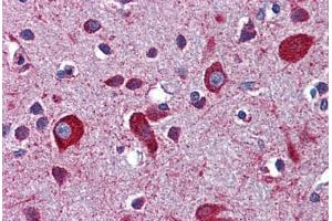 Immunohistochemistry (Formalin-fixed Paraffin-embedded Sections) (IHC (fp)) image for anti-Low Density Lipoprotein Receptor-Related Protein 8, Apolipoprotein E Receptor (LRP8) (AA 395-444) antibody (ABIN768922)
