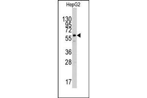 Image no. 1 for anti-Phosphoribosyl Pyrophosphate Amidotransferase (PPAT) (Middle Region) antibody (ABIN357903) (PPAT Antikörper  (Middle Region))
