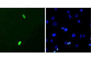 Immunocytochemistry/Immunofluorescence analysis using Mouse Anti-DUX4 Monoclonal Antibody, Clone P2B1 (ABIN863109). (DUX4 Antikörper  (C-Term))