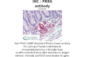 Image no. 1 for anti-PRKG antibody (ABIN1738352) (PRKG Antikörper)