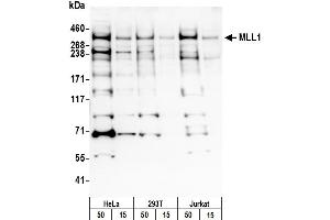 anti-Myeloid/lymphoid Or Mixed-Lineage Leukemia 1 (MLL1) (AA 1320-1380) antibody