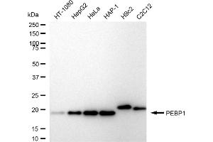 anti-Phosphatidylethanolamine Binding Protein 1 (PEBP1) antibody