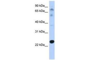 Image no. 1 for anti-Cysteine-Rich Hydrophobic Domain 2 (CHIC2) (N-Term) antibody (ABIN6743442) (CHIC2 Antikörper  (N-Term))