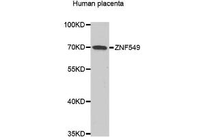 Western blot analysis of extracts of human placenta, using ZNF549 antibody. (ZNF549 Antikörper)
