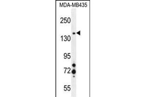 MET Antibody (ABIN1881539 and ABIN2845394) western blot analysis in MDA-M cell line lysates (35 μg/lane). (c-MET Antikörper)