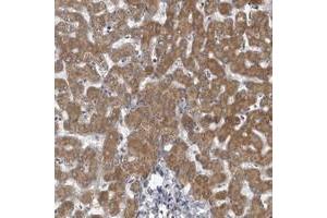 Immunohistochemical staining of human liver with LYSMD1 polyclonal antibody  shows moderate cytoplasmic positivity in hepatocytes. (LYSMD1 Antikörper)