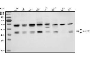 Western blot analysis of HNRNPH3 using anti-HNRNPH3 antibody (ABIN7601121).