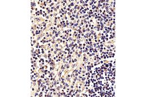 (ABIN6242561 and ABIN6577995) staining STAT5A in Human thymus tissue sections by Immunohistochemistry (IHC-P - paraformaldehyde-fixed, paraffin-embedded sections). (STAT5A Antikörper  (C-Term))