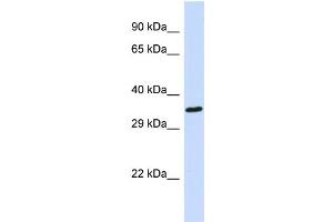 Host: Rabbit Target Name: EWSR1 Sample Type: 721_B Whole cell lysates Antibody Dilution: 1. (EWSR1 Antikörper  (C-Term))