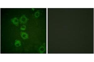 Immunofluorescence analysis of HuvEc cells, using Caspase 6 (Ab-257) Antibody. (Caspase 6 Antikörper  (AA 223-272))