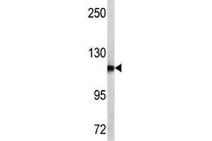 Western blot analysis of NPEPPS antibody and MCF-7 lysate. (NPEPPS Antikörper  (AA 709-737))