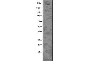 Western blot analysis of HTT using HuvEc whole  lysates. (Huntingtin Antikörper  (N-Term))