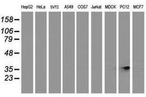 Image no. 3 for anti-Retinol Dehydrogenase 14 (All-Trans/9-Cis/11-Cis) (RDH14) antibody (ABIN1500656) (RDH14 Antikörper)