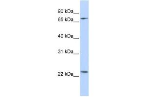 Western Blotting (WB) image for anti-Zinc Finger Protein 185 (ZNF185) antibody (ABIN2458345) (Zinc Finger Protein 185 Antikörper)