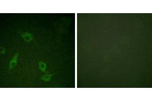 Peptide - +Immunofluorescence analysis of HeLa cells, using FAK (Ab-397) antibody. (FAK Antikörper  (Tyr397))