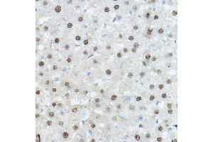 Immunohistochemistry of paraffin-embedded Mouse liver using CEBPA Rabbit pAb (ABIN6131380, ABIN6138380, ABIN6138381 and ABIN6214018) at dilution of 1:100 (40x lens). (CEBPA Antikörper  (AA 1-205))