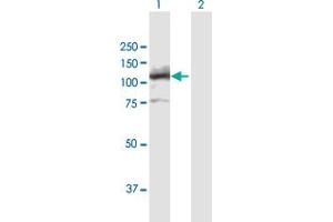 Western Blot analysis of LIG4 expression in transfected 293T cell line by LIG4 MaxPab polyclonal antibody. (LIG4 Antikörper  (AA 1-911))