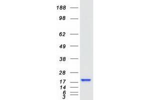 Western Blotting (WB) image for Acid Phosphatase 1, Soluble (ACP1) (Transcript Variant 2) protein (Myc-DYKDDDDK Tag) (ABIN2714333)
