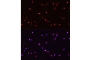 Immunofluorescence analysis of C6 cells using ILF3 antibody (ABIN3023309, ABIN3023310, ABIN3023311 and ABIN6219571) at dilution of 1:100. (Interleukin enhancer-binding factor 3 (ILF3) (AA 1-270) Antikörper)