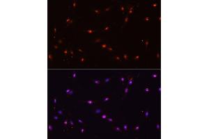 Immunofluorescence analysis of C6 cells using ILF3 antibody (ABIN3023309, ABIN3023310, ABIN3023311 and ABIN6219571) at dilution of 1:100. (Interleukin enhancer-binding factor 3 (ILF3) (AA 1-270) Antikörper)