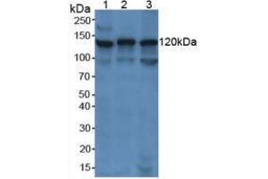 Western blot analysis of (1) Human Jurkat Cells, (2) Human K562 Cells and (3) Human Raji Cells. (PARP1 Antikörper  (AA 661-881))