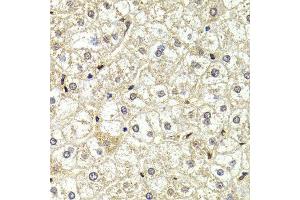 Immunohistochemistry of paraffin-embedded liver injury using LMNB2 antibody at dilution of 1:200 (400x lens). (Lamin B2 Antikörper)