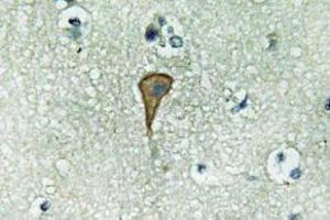 Immunohistochemistry (IHC) analyzes of IL-20Ralpha antibody in paraffin-embedded human brain tissue. (IL20RA Antikörper)