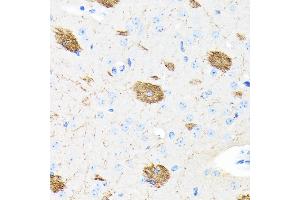 Immunohistochemistry (IHC) image for anti-Amyloid beta (A4) Precursor Protein (APP) antibody (ABIN7265575)