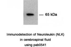 Image no. 1 for anti-Glucose-6-Phosphate Isomerase (GPI) antibody (ABIN347737) (GPI Antikörper)
