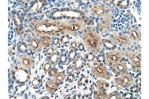 Immunohistochemistry (IHC) image for anti-C-Type Lectin Domain Family 4, Member M (CLEC4M) (N-Term) antibody (ABIN630277)