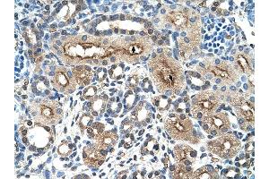 CLEC4M antibody was used for immunohistochemistry at a concentration of 4-8 ug/ml to stain Epithelial cells of renal tubule (arrows) in Human Kidney.