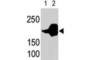 LRP5 polyclonal antibody  is used in Western blot to detect recombinant human LRP5 (Lane 1) and mouse LRP5 (Lane 2) proteins in transfected 293 cell lysates. (LRP5 Antikörper  (C-Term))