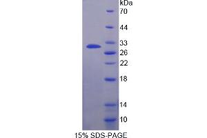 Image no. 1 for Kallikrein 10 (KLK10) (AA 35-276) protein (His tag) (ABIN6236684)