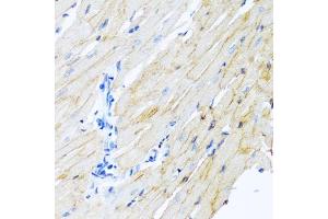 Immunohistochemistry of paraffin-embedded rat heart using ADAM17 antibody. (ADAM17 Antikörper)