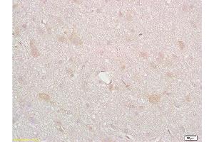 Formalin-fixed and paraffin embedded rat brain tissue labeled with Anti-DRD2 Polyclonal Antibody, Unconjugated  at 1:200, followed by conjugation to the secondary antibody and DAB staining (Dopamine d2 Receptor Antikörper  (AA 201-300))
