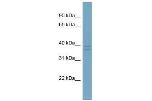 WB Suggested Anti-CXorf66 Antibody Titration:  0. (CXorf66 Antikörper  (Middle Region))