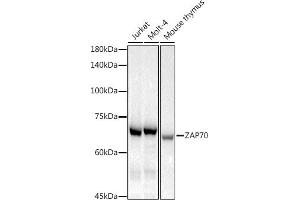 Western blot analysis of extracts of various cell lines, using Z antibody (ABIN7271430) at 1:1000 dilution. (ZAP70 Antikörper)