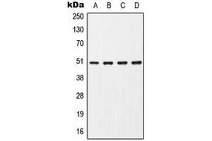 Western blot analysis of CHRNA7 expression in HepG2 (A), Jurkat (B), Raw264. (CHRNA7 Antikörper  (Center))