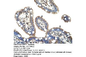 Human Intestine (DMP1 Antikörper  (C-Term))