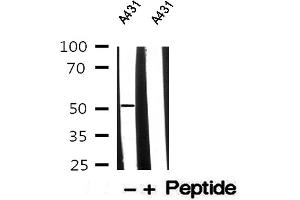 Western blot analysis of A431 whole cell lysates, using Cytokeratin 13 Antibody. (Cytokeratin 13 Antikörper  (Internal Region))