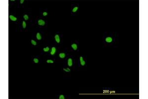 Immunofluorescence of monoclonal antibody to PARP1 on HeLa cell. (PARP1 Antikörper  (AA 1-100))