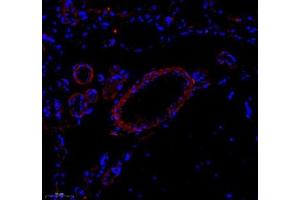 Immunofluorescence of paraffin embedded rat brain using Enfb3 (ABIN7073845) at dilution of 1: 600 (250x lens) (Ephrin B3 Antikörper)