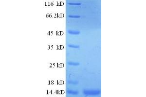 SDS-PAGE (SDS) image for Prostate Stem Cell Antigen (PSCA) (AA 21-95) protein (His tag) (ABIN5712806)