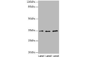 Western blot All lanes: AZGP1 antibody at 4 μg/mL Lane 1: PC-3 whole cell lysate Lane 2: HepG2 whole cell lysate Lane 3: K562 whole cell lysate Secondary Goat polyclonal to rabbit IgG at 1/10000 dilution Predicted band size: 35 kDa Observed band size: 35 kDa (AZGP1 Antikörper  (AA 61-210))