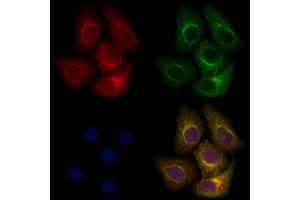 ABIN6263108 and ABIN6266800 staining Hela cells by IF/ICC.