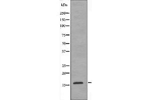 Western blot analysis of extracts from K562 cells, using MRPS18C antibody. (MRPS18C Antikörper  (Internal Region))